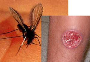 Lesões são confundidas com hanseníase, câncer ou micoses